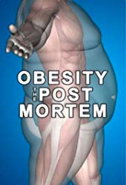 Obesity: The Post Mortem (2016) M4ufree